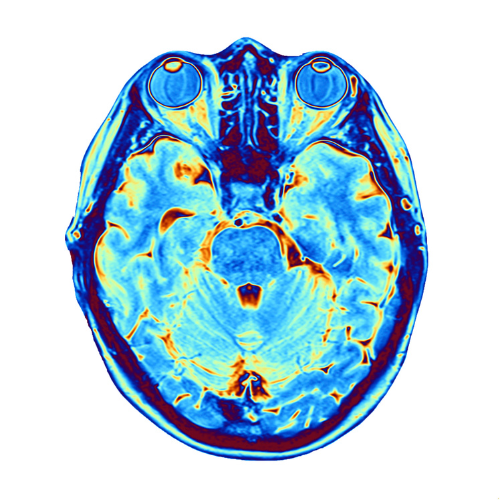 Rezonans Magnetyczny - Obrazowanie Struktury Mózgu