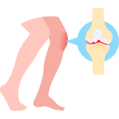 Uszkodzenia więzadeł