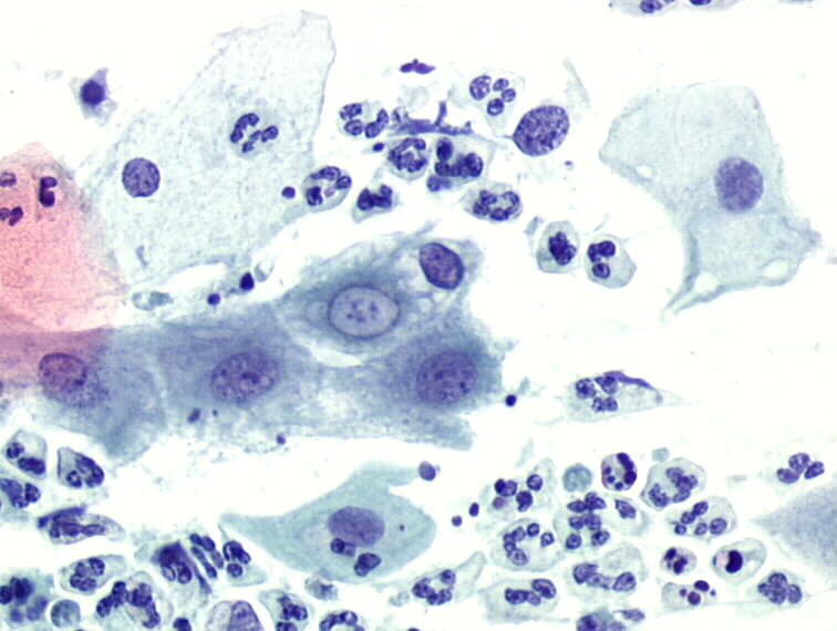 Chlamydia trachomatis