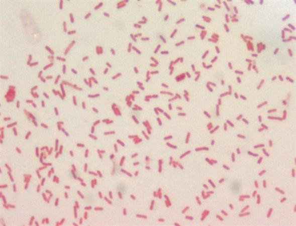 Yersinia pestis