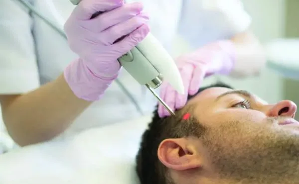 Niskoenergetyczna terapia laserowa