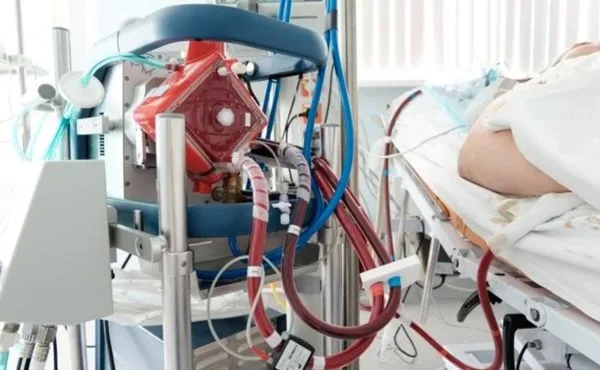 ECMO
