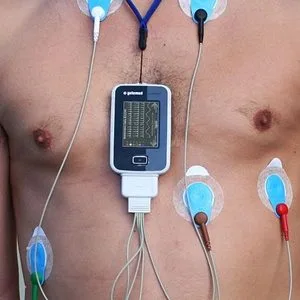 Holter EKG