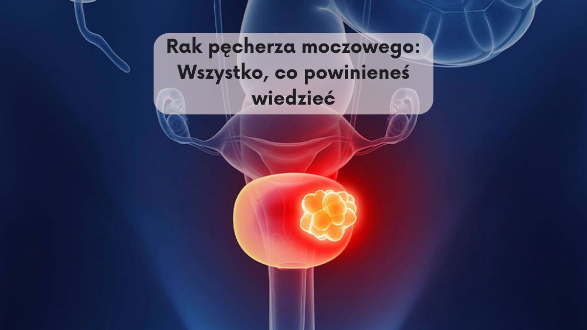 Rak pęcherza moczowego: Wszystko, co powinieneś wiedzieć