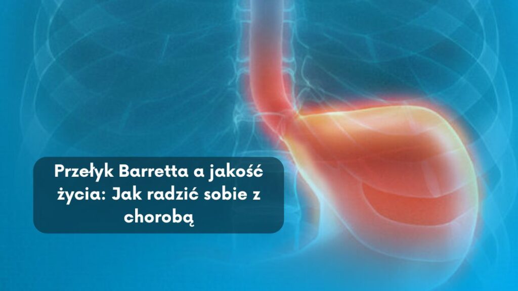 Przełyk Barretta a jakość życia: Jak radzić sobie z chorobą