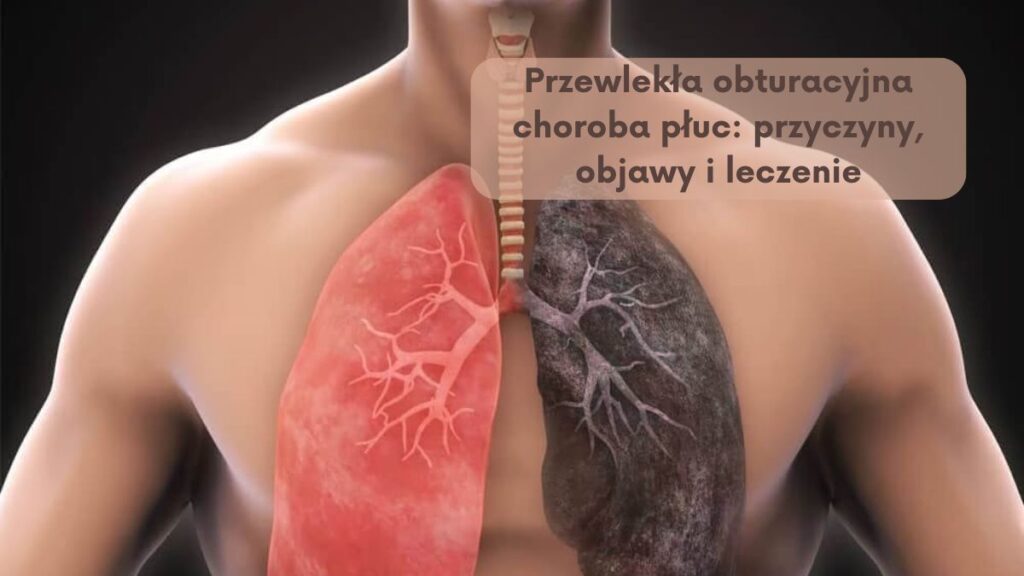 Przewlekła obturacyjna choroba płuc: przyczyny, objawy i leczenie