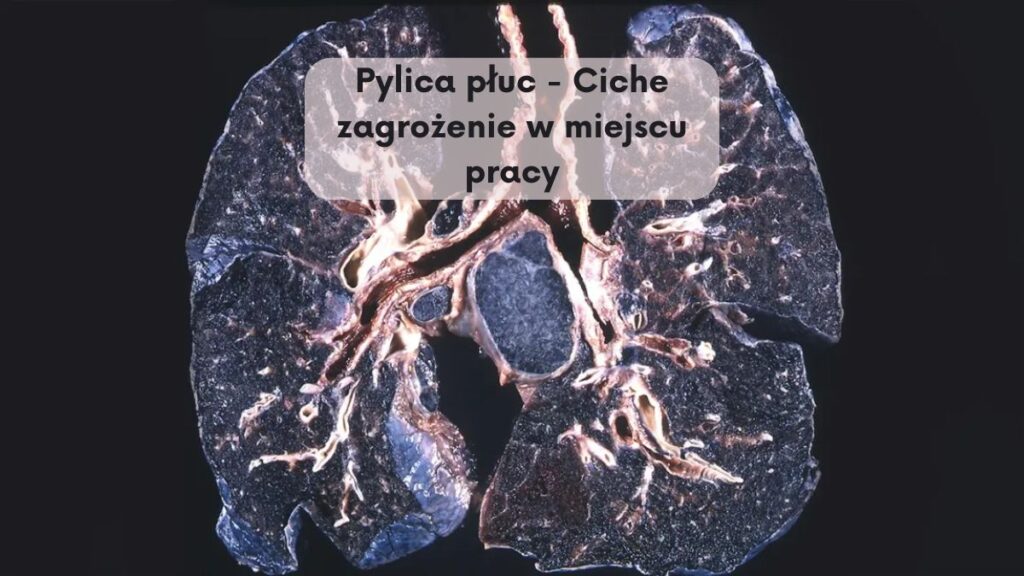 Pylica płuc - Ciche zagrożenie w miejscu pracy