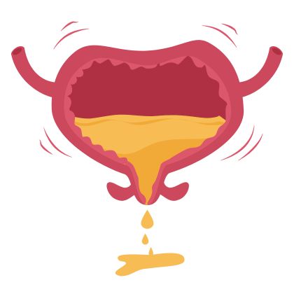 Problemy z utrzymaniem moczu