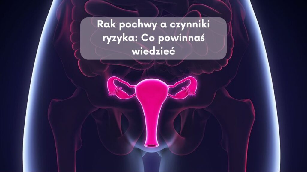 Rak pochwy a czynniki ryzyka: Co powinnaś wiedzieć