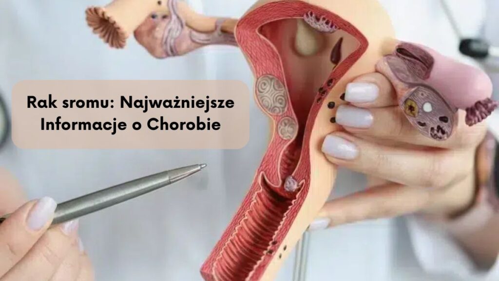 Rak sromu: Najważniejsze Informacje o Chorobie