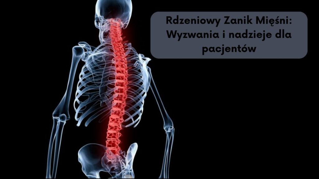 Rdzeniowy Zanik Mięśni: Wyzwania i nadzieje dla pacjentów