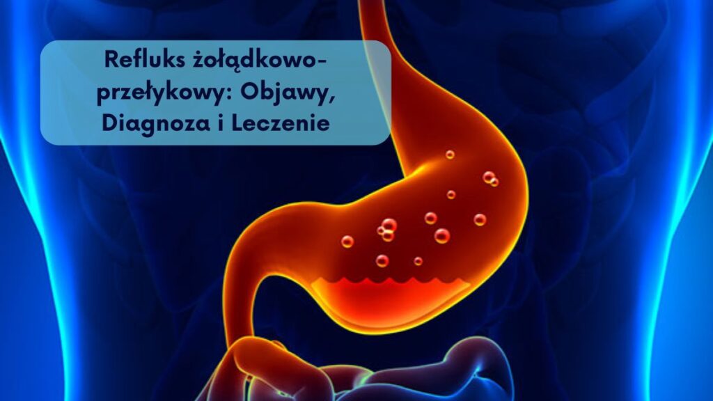 Refluks żołądkowo-przełykowy: Objawy, Diagnoza i Leczenie