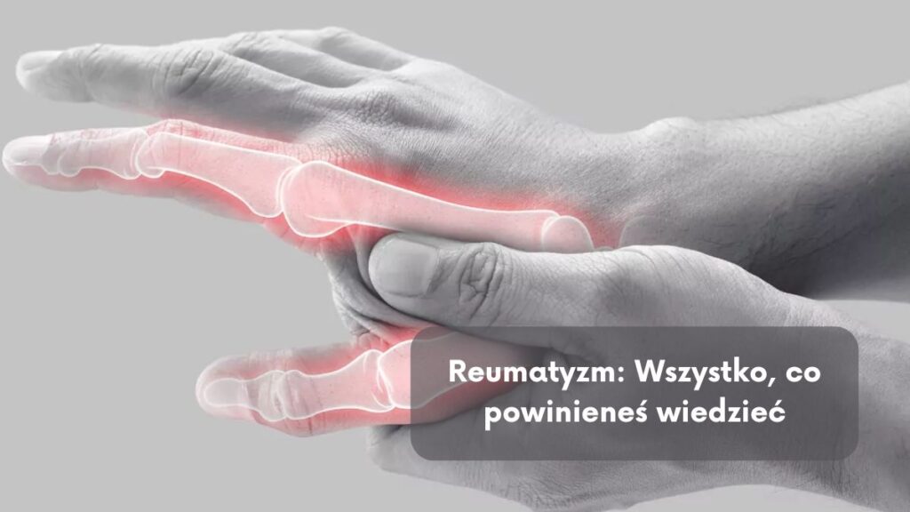Reumatyzm: Wszystko, co powinieneś wiedzieć