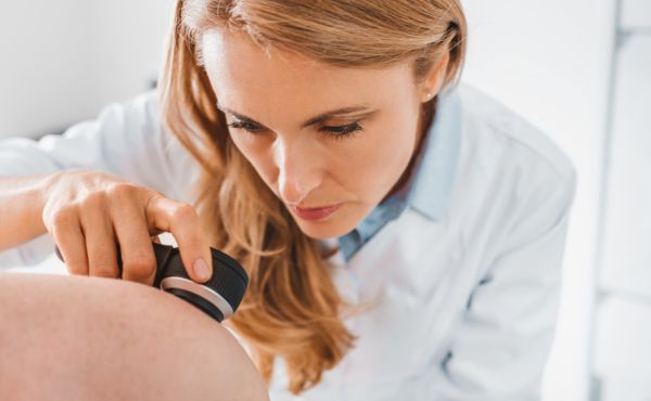 Konsultacja z dermatologiem