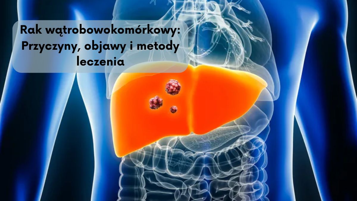 Rak wątrobowokomórkowy: Przyczyny, objawy i metody leczenia