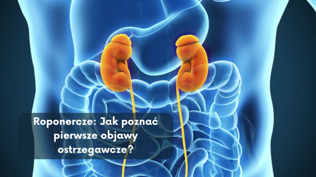 Roponercze: Jak poznać pierwsze objawy ostrzegawcze?