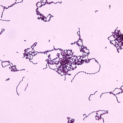 Streptococcus pyogenes
