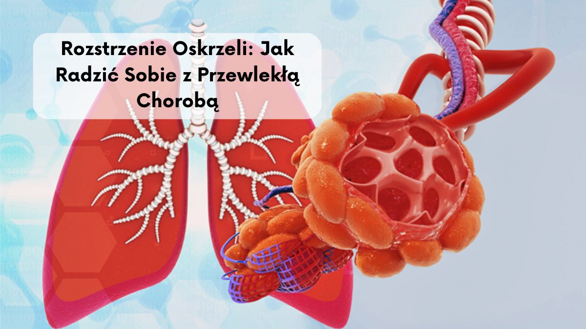 Rozstrzenie Oskrzeli: Jak Radzić Sobie z Przewlekłą Chorobą