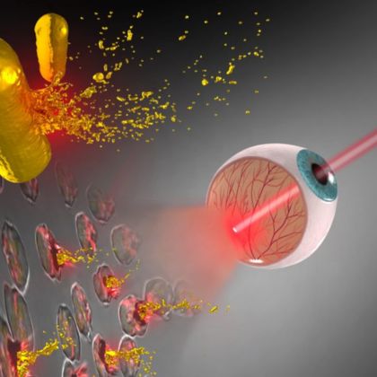 Laseroterapia