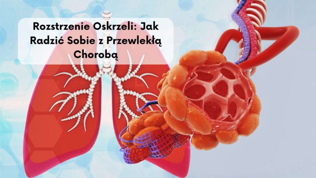 Rozstrzenie Oskrzeli: Jak Radzić Sobie z Przewlekłą Chorobą