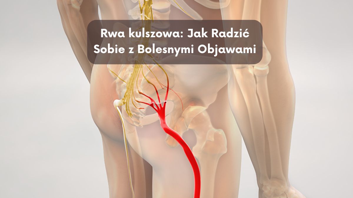 Rwa kulszowa: Jak Radzić Sobie z Bolesnymi Objawami