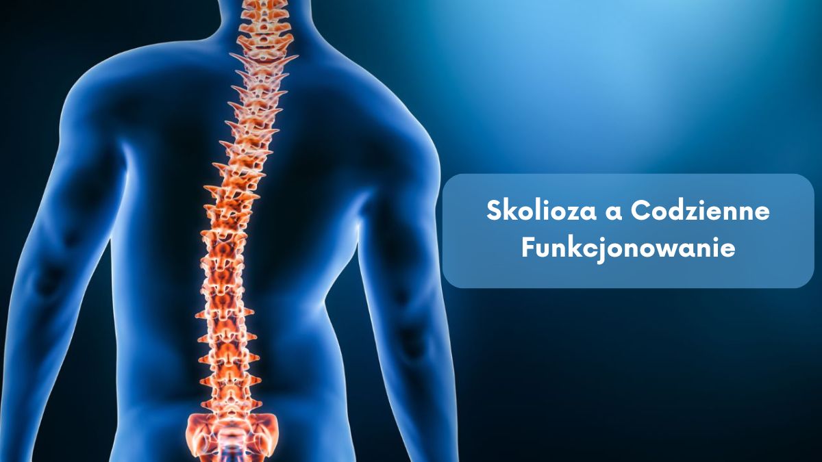 Skolioza a Codzienne Funkcjonowanie
