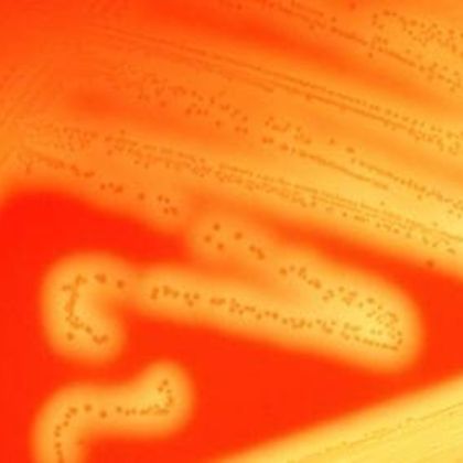 Paciorkowce beta-hemolizujące