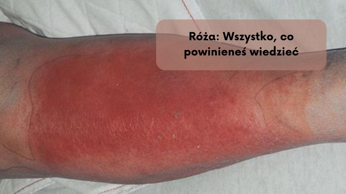 Róża: Wszystko, co powinieneś wiedzieć