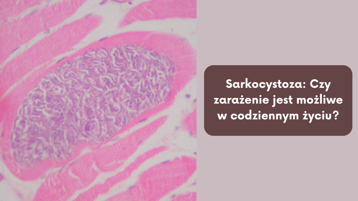 Sarkocystoza Czy zarażenie jest możliwe w codziennym życiu