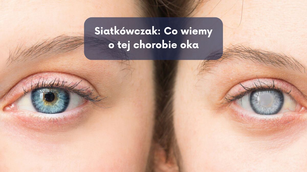 Siatkówczak: Co wiemy o tej chorobie oka