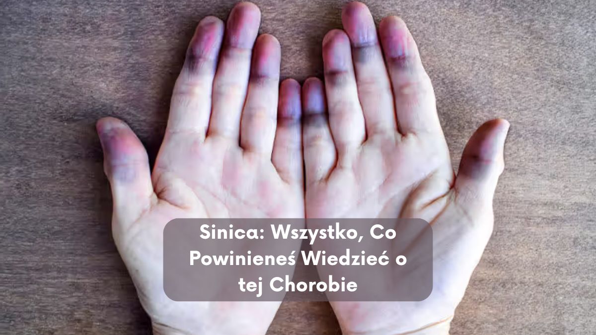 Sinica: Wszystko, Co Powinieneś Wiedzieć o tej Chorobie