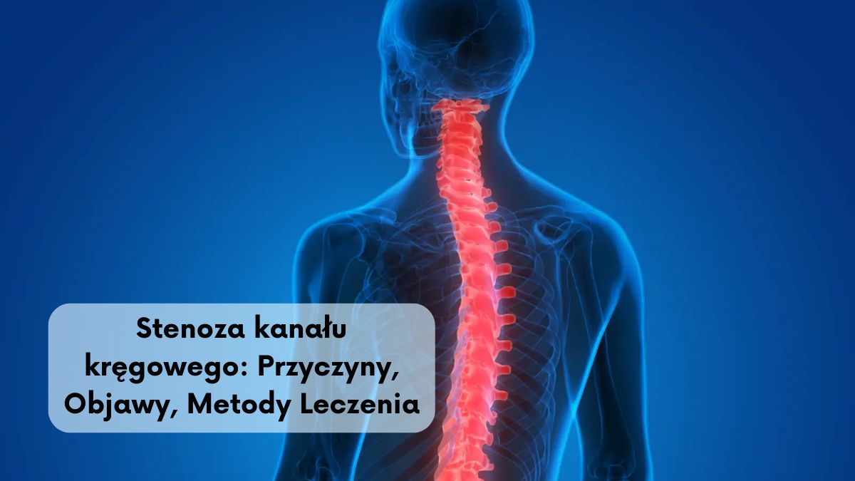 Stenoza kanału kręgowego: Przyczyny, Objawy, Metody Leczenia