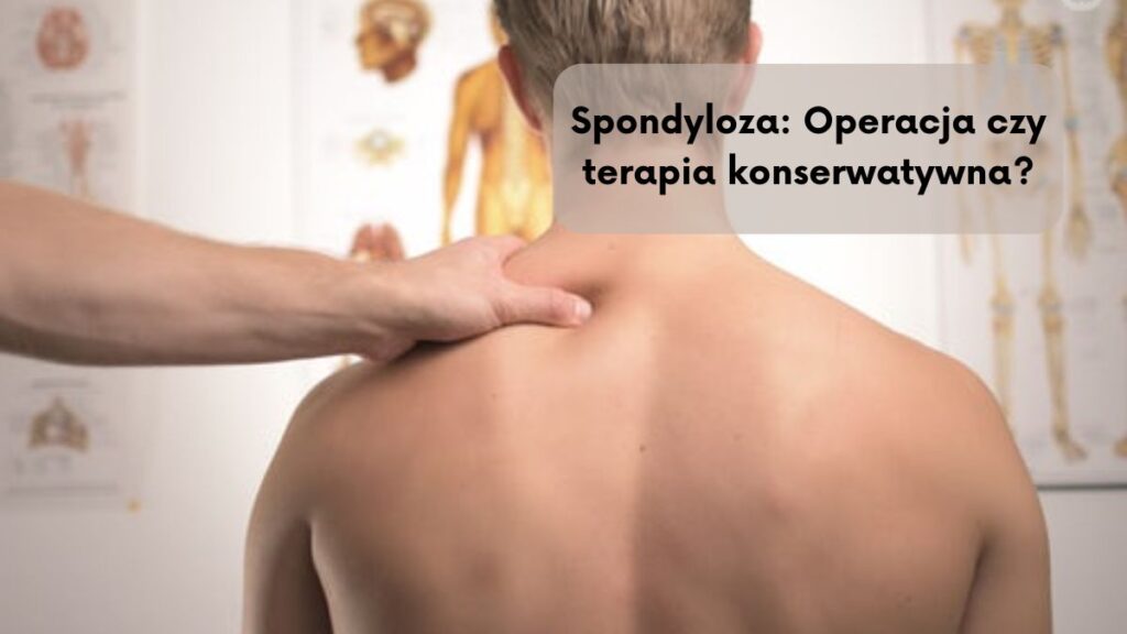 Spondyloza: Operacja czy terapia konserwatywna?