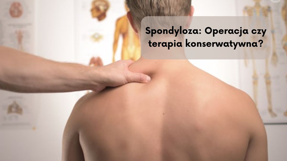 Spondyloza: Operacja czy terapia konserwatywna?